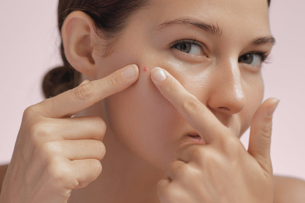 Achieve Clear, Smooth Skin: Effective Acne Treatment Products for Every Skin Type