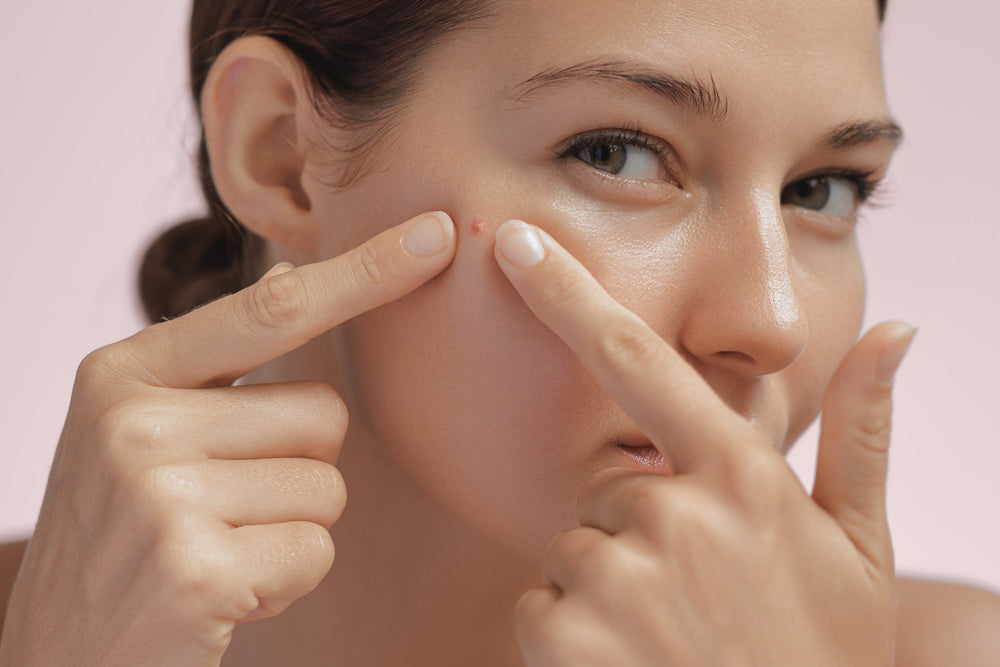 Clear Bliss: Meet Our All-Time Bestseller for Blemish and Acne Control